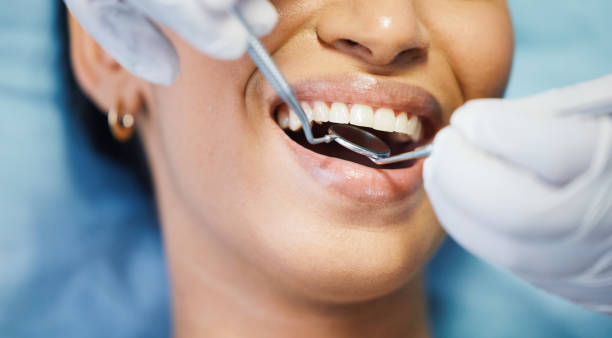 Best Emergency Dental Extractions in Bangs, TX